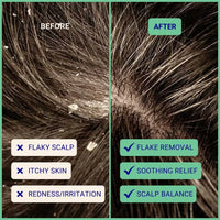 Exfoliating Shampoo For Loose Dandruff Flakes Tea Tree & Salicylic Acid 20g / 0.70oz