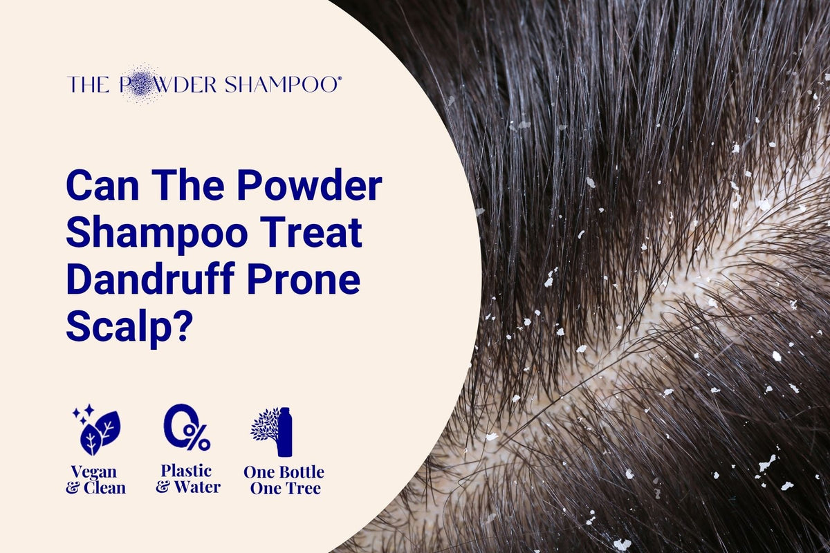 Can The Powder Shampoo Treat Dandruff Prone Scalp?